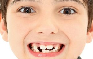 Giải mã giấc mơ thấy răng có ý nghĩa gì?