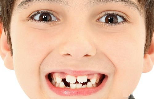 Giải mã giấc mơ thấy răng có ý nghĩa gì?